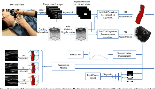 Figure 1 for Automatic Diagnosis of Carotid Atherosclerosis Using a Portable Freehand 3D Ultrasound Imaging System