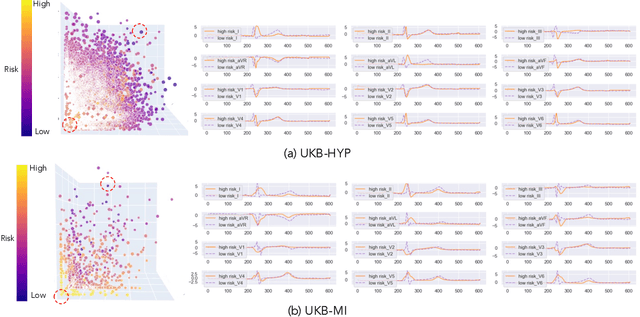 Figure 4 for Large Language Model-informed ECG Dual Attention Network for Heart Failure Risk Prediction