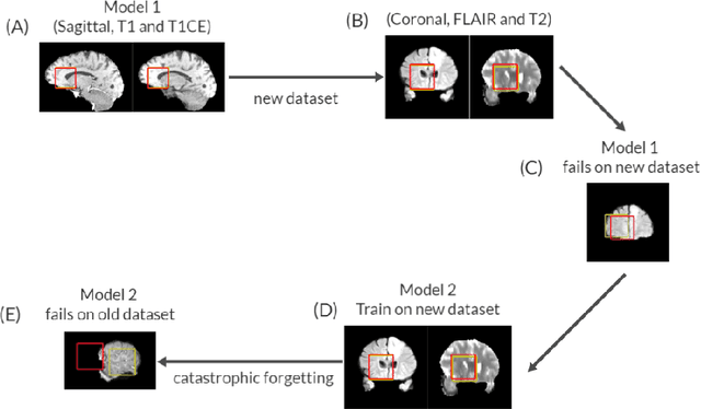 Figure 1 for Multi-environment lifelong deep reinforcement learning for medical imaging