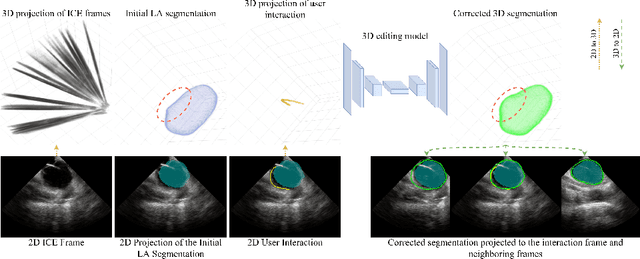 Figure 3 for From Sparse to Precise: A Practical Editing Approach for Intracardiac Echocardiography Segmentation