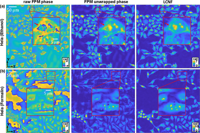 Figure 3 for Local Conditional Neural Fields for Versatile and Generalizable Large-Scale Reconstructions in Computational Imaging