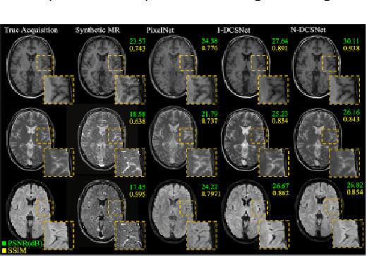 Figure 3 for High-fidelity Direct Contrast Synthesis from Magnetic Resonance Fingerprinting