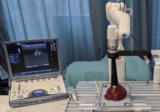 Figure 1 for Automated robotic intraoperative ultrasound for brain surgery