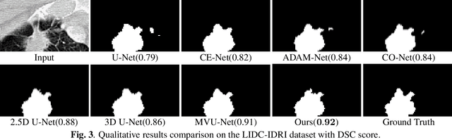Figure 4 for Adjacent Slice Feature Guided 2.5D Network for Pulmonary Nodule Segmentation