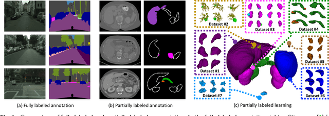 Figure 1 for Learning from partially labeled data for multi-organ and tumor segmentation