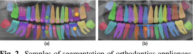 Figure 2 for Enhanced Masked Image Modeling for Analysis of Dental Panoramic Radiographs