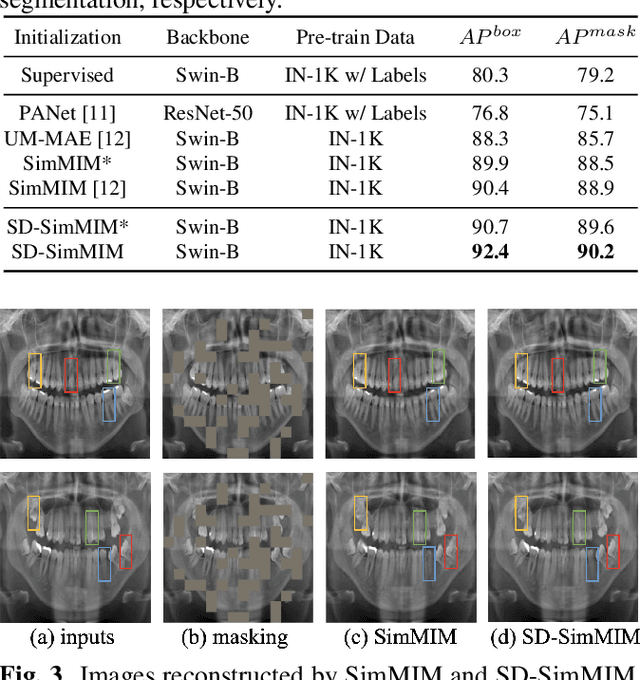 Figure 4 for Enhanced Masked Image Modeling for Analysis of Dental Panoramic Radiographs