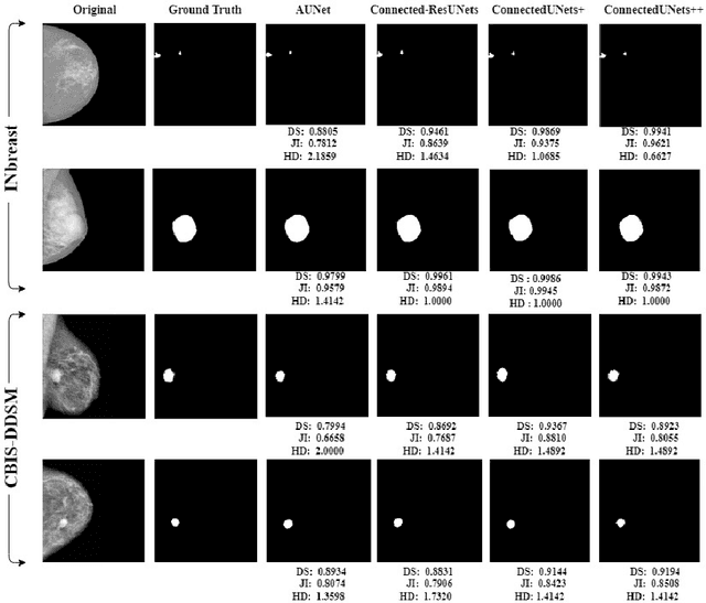 Figure 4 for ConnectedUNets++: Mass Segmentation from Whole Mammographic Images