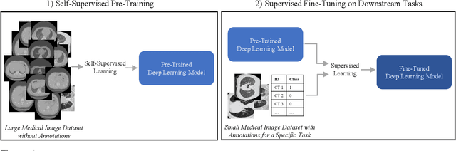 Figure 1 for Dealing with Small Datasets for Deep Learning in Medical Imaging: An Evaluation of Self-Supervised Pre-Training on CT Scans Comparing Contrastive and Masked Autoencoder Methods for Convolutional Models