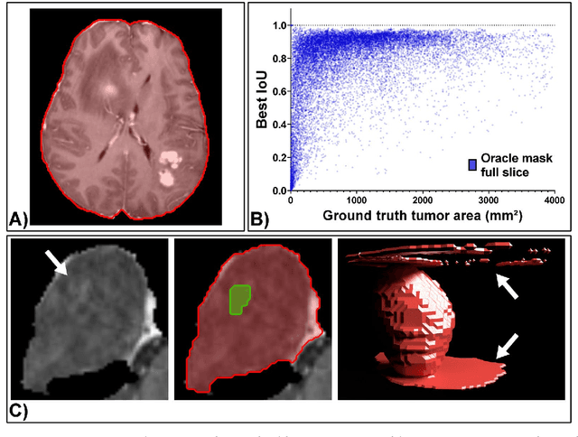 Figure 4 for The Segment Anything foundation model achieves favorable brain tumor autosegmentation accuracy on MRI to support radiotherapy treatment planning