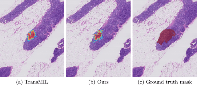 Figure 4 for Structured State Space Models for Multiple Instance Learning in Digital Pathology
