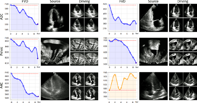 Figure 4 for OnUVS: Online Feature Decoupling Framework for High-Fidelity Ultrasound Video Synthesis