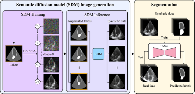 Figure 1 for Echo from noise: synthetic ultrasound image generation using diffusion models for real image segmentation