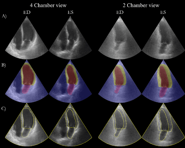 Figure 3 for Echo from noise: synthetic ultrasound image generation using diffusion models for real image segmentation