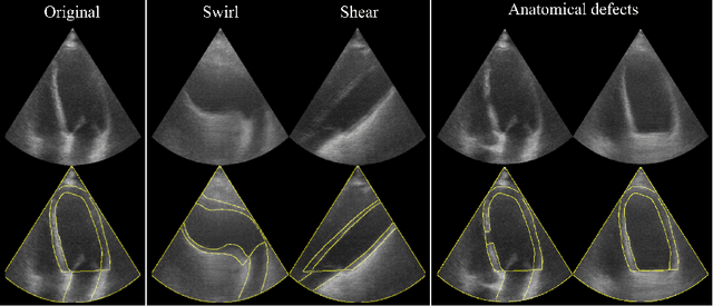 Figure 4 for Echo from noise: synthetic ultrasound image generation using diffusion models for real image segmentation