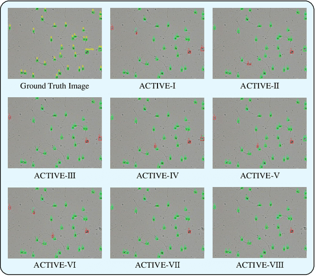 Figure 2 for ACTIVE: A Deep Model for Sperm and Impurity Detection in Microscopic Videos