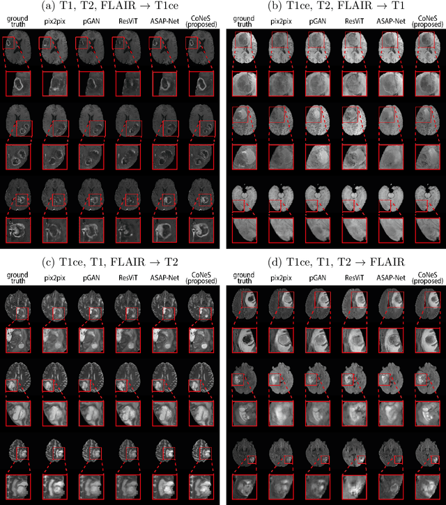 Figure 3 for CoNeS: Conditional neural fields with shift modulation for multi-sequence MRI translation