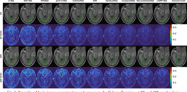 Figure 3 for CAMP-Net: Context-Aware Multi-Prior Network for Accelerated MRI Reconstruction