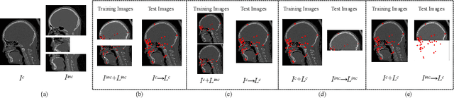 Figure 1 for Multi-Target Landmark Detection with Incomplete Images via Reinforcement Learning and Shape Prior