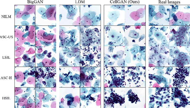 Figure 4 for CellGAN: Conditional Cervical Cell Synthesis for Augmenting Cytopathological Image Classification