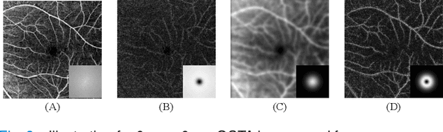 Figure 2 for Unpaired Optical Coherence Tomography Angiography Image Super-Resolution via Frequency-Aware Inverse-Consistency GAN