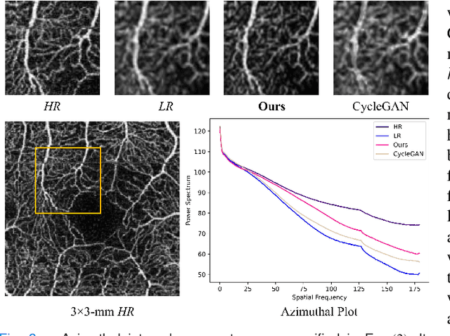 Figure 3 for Unpaired Optical Coherence Tomography Angiography Image Super-Resolution via Frequency-Aware Inverse-Consistency GAN