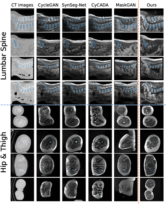 Figure 4 for ContourDiff: Unpaired Image Translation with Contour-Guided Diffusion Models