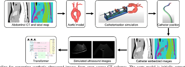 Figure 2 for AiAReSeg: Catheter Detection and Segmentation in Interventional Ultrasound using Transformers