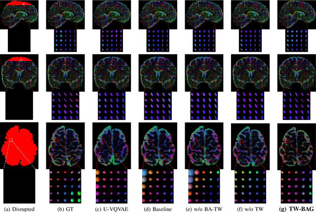 Figure 3 for TW-BAG: Tensor-wise Brain-aware Gate Network for Inpainting Disrupted Diffusion Tensor Imaging