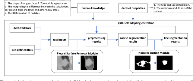 Figure 1 for A Coarse-to-fine Morphological Approach With Knowledge-based Rules and Self-adapting Correction for Lung Nodules Segmentation
