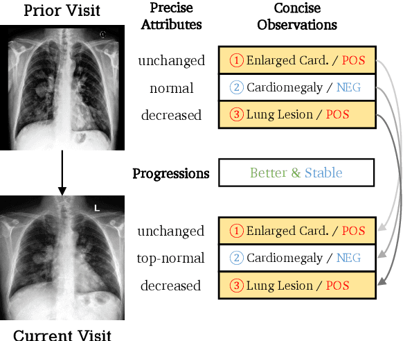 Figure 1 for RECAP: Towards Precise Radiology Report Generation via Dynamic Disease Progression Reasoning