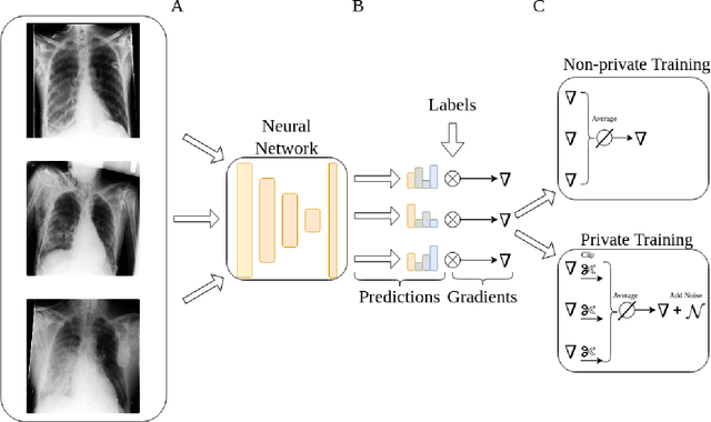 Figure 1 for Private, fair and accurate: Training large-scale, privacy-preserving AI models in radiology