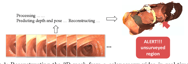 Figure 1 for A Surface-normal Based Neural Framework for Colonoscopy Reconstruction