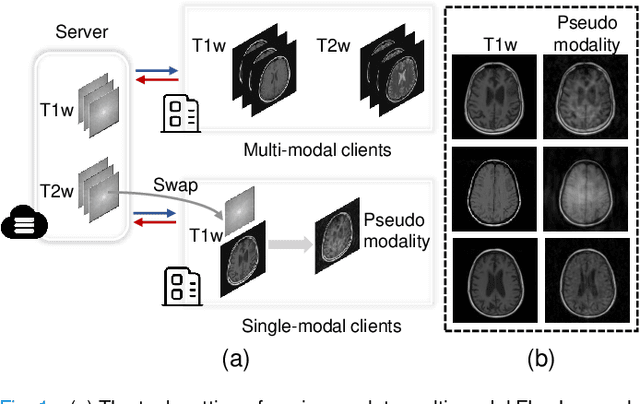 Figure 1 for Federated Pseudo Modality Generation for Incomplete Multi-Modal MRI Reconstruction