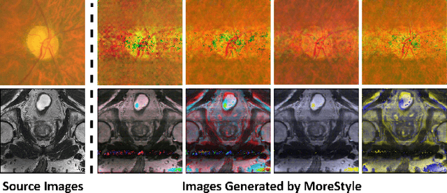 Figure 3 for MoreStyle: Relax Low-frequency Constraint of Fourier-based Image Reconstruction in Generalizable Medical Image Segmentation