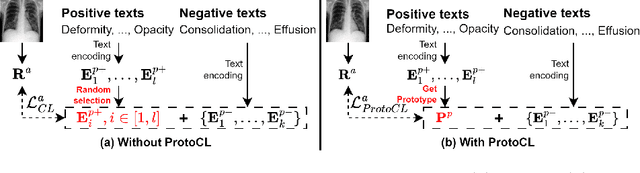 Figure 3 for MeDSLIP: Medical Dual-Stream Language-Image Pre-training for Fine-grained Alignment
