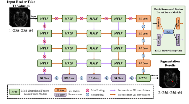 Figure 3 for An Unpaired Cross-modality Segmentation Framework Using Data Augmentation and Hybrid Convolutional Networks for Segmenting Vestibular Schwannoma and Cochlea