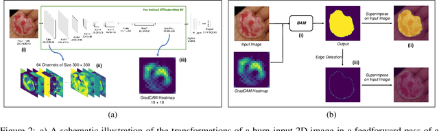 Figure 3 for Boundary Attention Mapping (BAM): Fine-grained saliency maps for segmentation of Burn Injuries