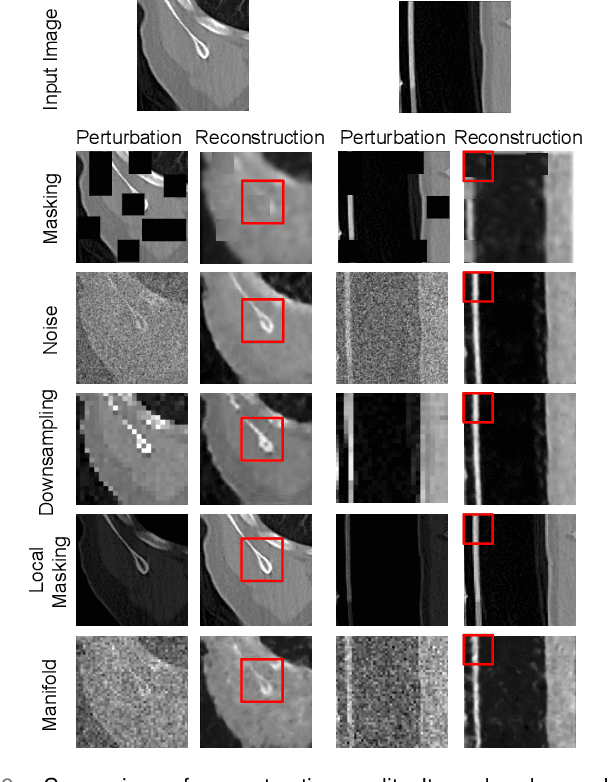 Figure 2 for Disruptive Autoencoders: Leveraging Low-level features for 3D Medical Image Pre-training