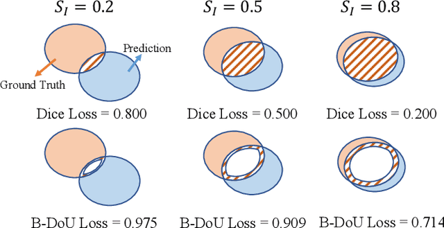 Figure 3 for Boundary Difference Over Union Loss For Medical Image Segmentation