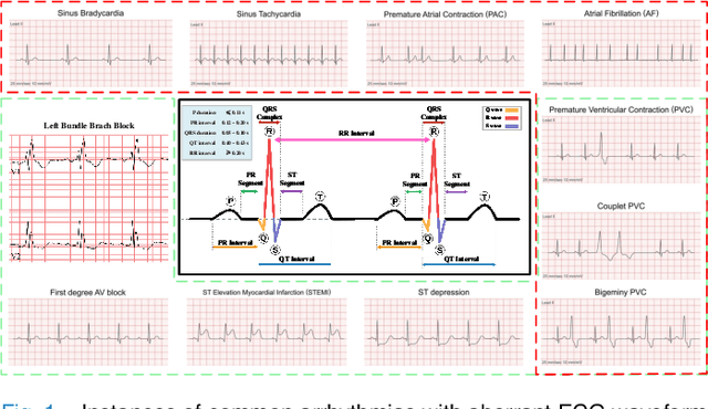 Figure 1 for ECG-CL: A Comprehensive Electrocardiogram Interpretation Method Based on Continual Learning