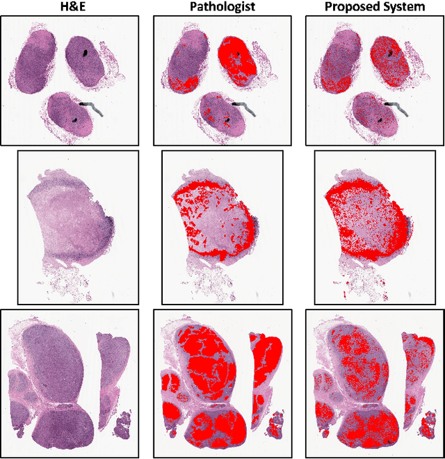 Figure 3 for Composite Biomarker Image for Advanced Visualization in Histopathology