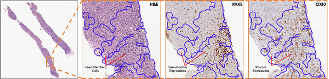 Figure 4 for Composite Biomarker Image for Advanced Visualization in Histopathology