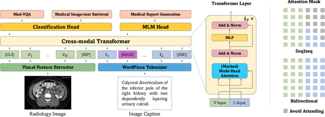 Figure 3 for Multi-modal Pre-training for Medical Vision-language Understanding and Generation: An Empirical Study with A New Benchmark