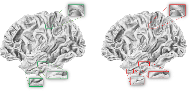 Figure 3 for Diffeomorphic Deformation via Sliced Wasserstein Distance Optimization for Cortical Surface Reconstruction
