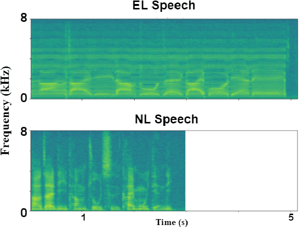 Figure 1 for Audio-Visual Mandarin Electrolaryngeal Speech Voice Conversion