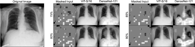Figure 4 for Delving into Masked Autoencoders for Multi-Label Thorax Disease Classification