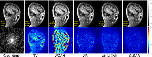 Figure 3 for Convex Latent-Optimized Adversarial Regularizers for Imaging Inverse Problems