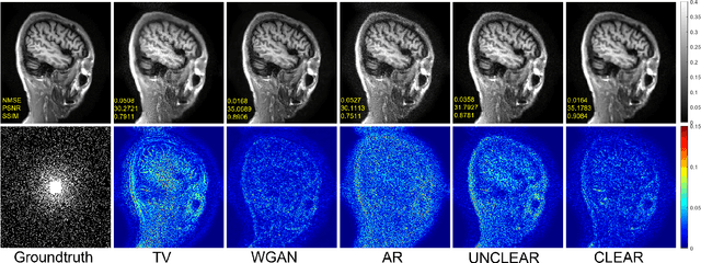 Figure 4 for Convex Latent-Optimized Adversarial Regularizers for Imaging Inverse Problems