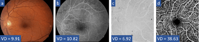 Figure 1 for MEMO: Dataset and Methods for Robust Multimodal Retinal Image Registration with Large or Small Vessel Density Differences